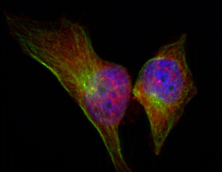 Anti-Phospho-HSPB1-S78 Antibody (CABP0236)