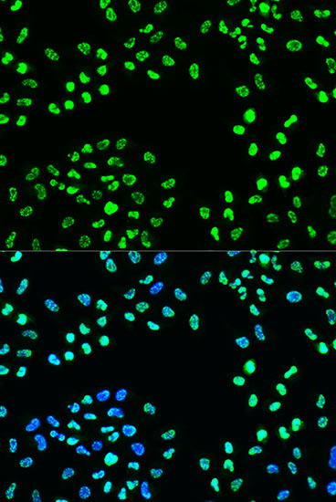 Anti-Phospho-ATR-S428 Antibody (CABP0676)