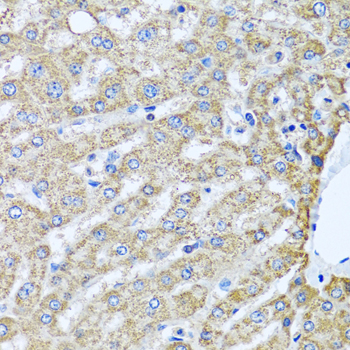 Anti-TMEM189 Polyclonal Antibody (CAB8380)