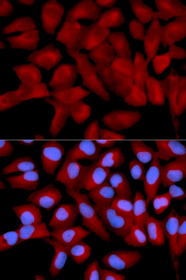 Anti-EIF5A Antibody (CAB2016)