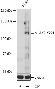 Anti-Phospho-JAK2-Y221 Antibody (CABP0374)