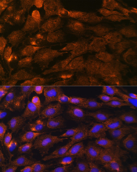 Anti-PTCH1 Antibody (CAB0826)