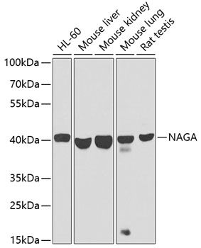 Anti-NAGA Polyclonal Antibody (CAB9942)