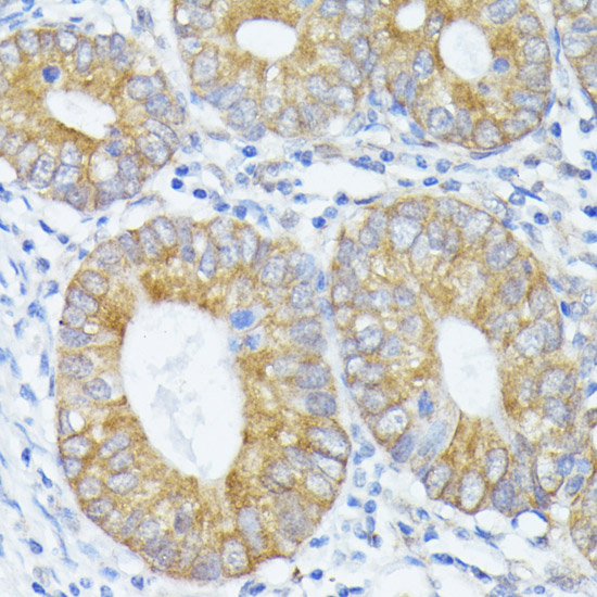 Anti-PFDN4 Antibody (CAB15300)