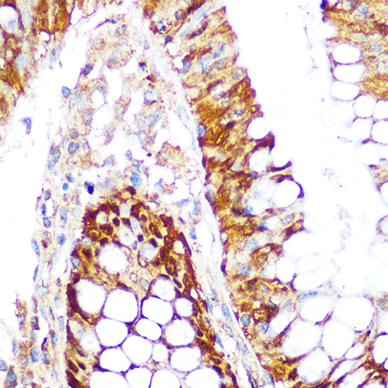 Anti-KEAP1 Antibody [KO Validated] (CAB17061)