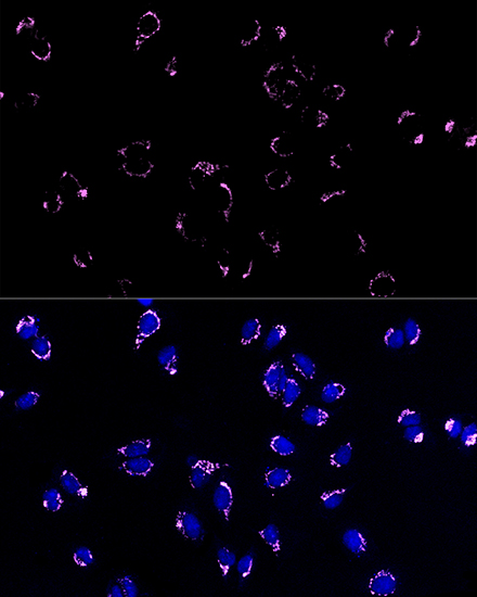 Anti-Alexa Fluor 647-conjugated Goat Anti-Rabbit IgG (H+L) Antibody