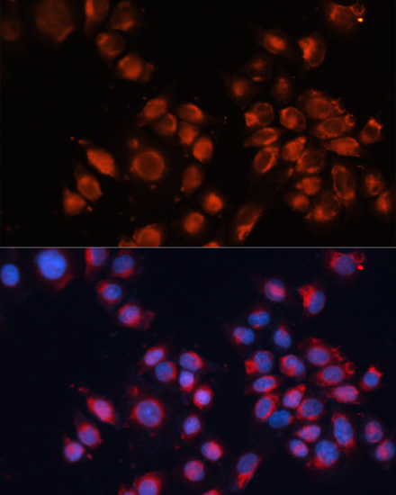 Anti-IGF2R Antibody (CAB13022)