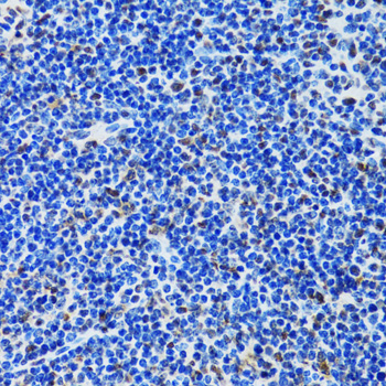 Anti-MTA3 Antibody (CAB6660)