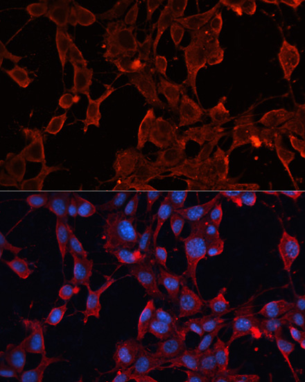 Anti-ADAM12 Antibody (CAB7940)