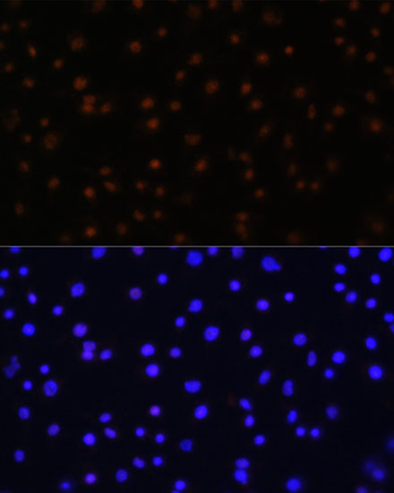 Anti-NPAS2 Antibody (CAB16930)