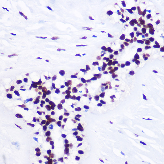 Anti-TriMethyl-Histone H3-K36 Antibody (CAB2366)