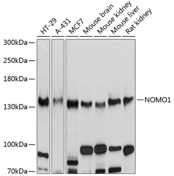 Anti-NOMO1 Antibody (CAB10510)