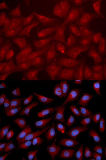 Anti-RAPGEF3 Antibody (CAB2199)