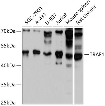 Anti-TRAF1 Antibody (CAB0150)