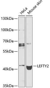 Anti-LEFTY2 Polyclonal Antibody (CAB9846)