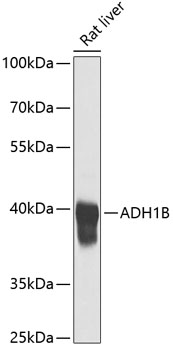 Anti-ADH1B Antibody (CAB1431)