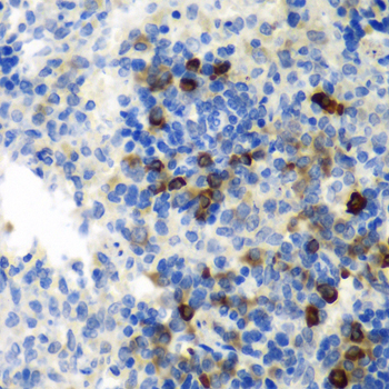 Anti-AIMP1 Antibody (CAB5301)