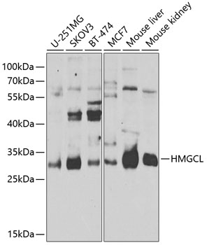 Anti-HMGCL Polyclonal Antibody (CAB8052)