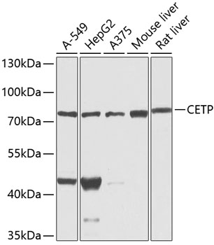 Anti-CETP Antibody (CAB1355)