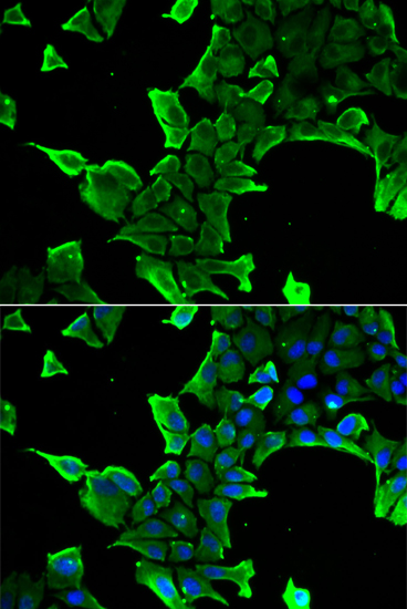 Anti-NCS1 Antibody (CAB13586)