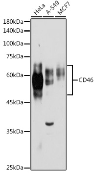 Anti-CD46 Antibody (CAB1653)