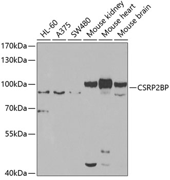 Anti-CSRP2BP Antibody (CAB7380)