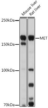 Anti-MET Antibody (CAB17366)