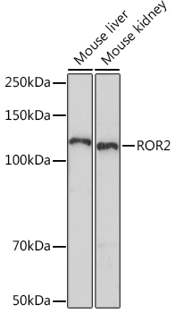 Anti-ROR2 Antibody (CAB5120)