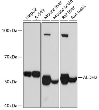 Anti-ALDH2 Antibody