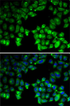 Anti-NEIL-1 Antibody (CAB5828)