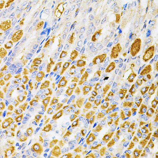 Anti-RPS6KA3 Antibody (CAB5436)