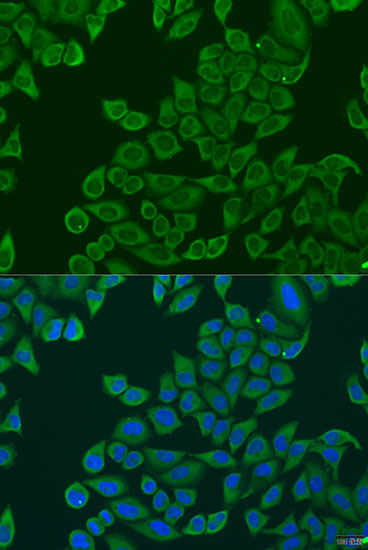 Anti-RPL36 Antibody (CAB7793)