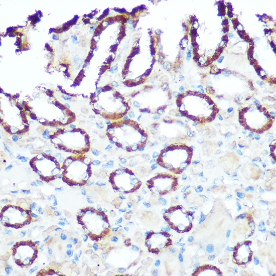 Anti-NDUFV1 Antibody (CAB13333)