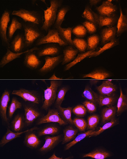 Anti-PSMD4 Antibody (CAB1061)