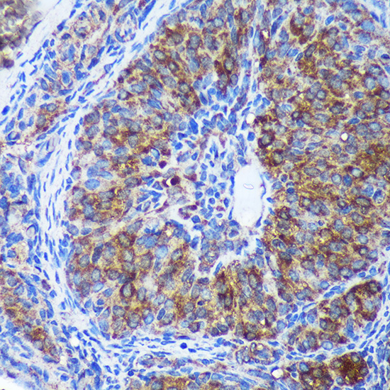 Anti-GULP1 Antibody (CAB3432)