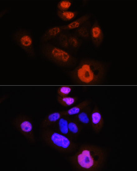 Anti-Phospho-YAP1-S127 Antibody (CABP0489)