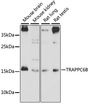 Anti-TRAPPC6B Antibody (CAB15561)