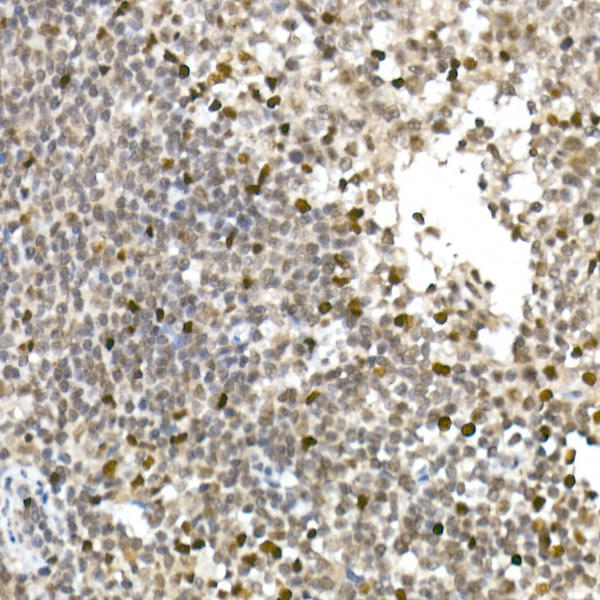 Immunohistochemistry of paraffin-embedded human tonsil using TCF1/TCF7 Rabbit mAb at dilution of 1:100 (40x lens). Perform high pressure antigen retrieval with 10 mM citrate buffer pH 6. 0 before commencing with IHC staining protocol.