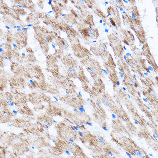 Anti-LATS2 Antibody (CAB16249)