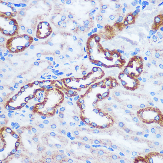 Anti-TOM20 Antibody (CAB16896)