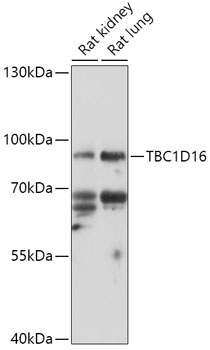 Anti-TBC1D16 Antibody (CAB17820)