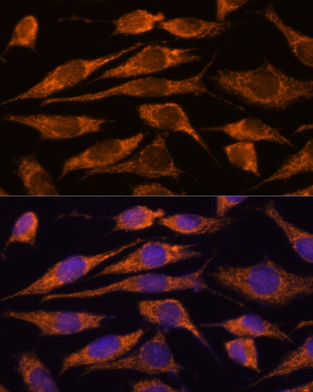 Anti-MTMR9 Antibody (CAB13124)