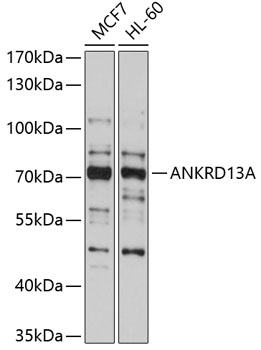 Anti-ANKRD13A Antibody (CAB10416)