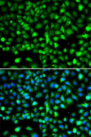 Anti-SMYD1 Antibody (CAB2340)