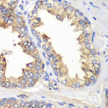 Anti-KLK10 Antibody (CAB13629)