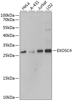 Anti-EXOSC4 Polyclonal Antibody (CAB9147)