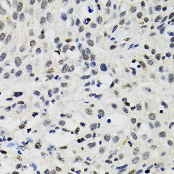 Anti-SMARCAD1 Antibody (CAB5850)