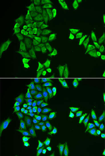 Anti-ACSS2 Antibody (CAB13596)