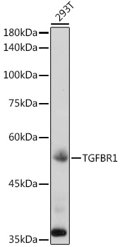 Anti-TGFBR1 Antibody (CAB0708)