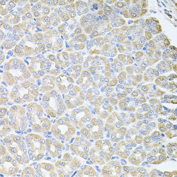 Anti-SKAP2 Antibody (CAB6435)